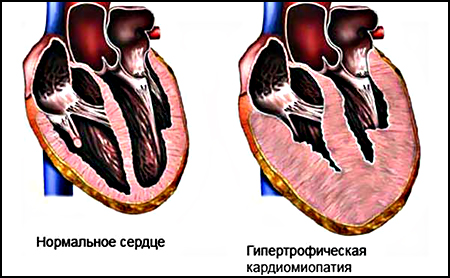 пивной алкоголизм, бычье сердце, выведение из запоя на дому, кодирование от алкоголизма, вызов нарколога на дом, диагностика на наркотики, скорая наркологическая помощь